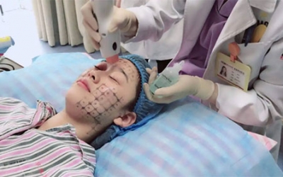 熱瑪吉有什么效果和副作用？