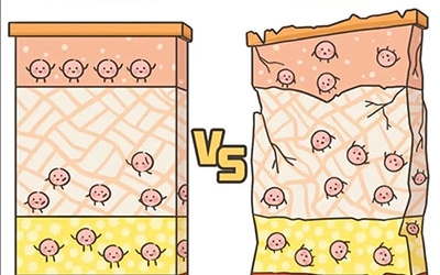 敏感性皮膚產(chǎn)生的原因是什么？